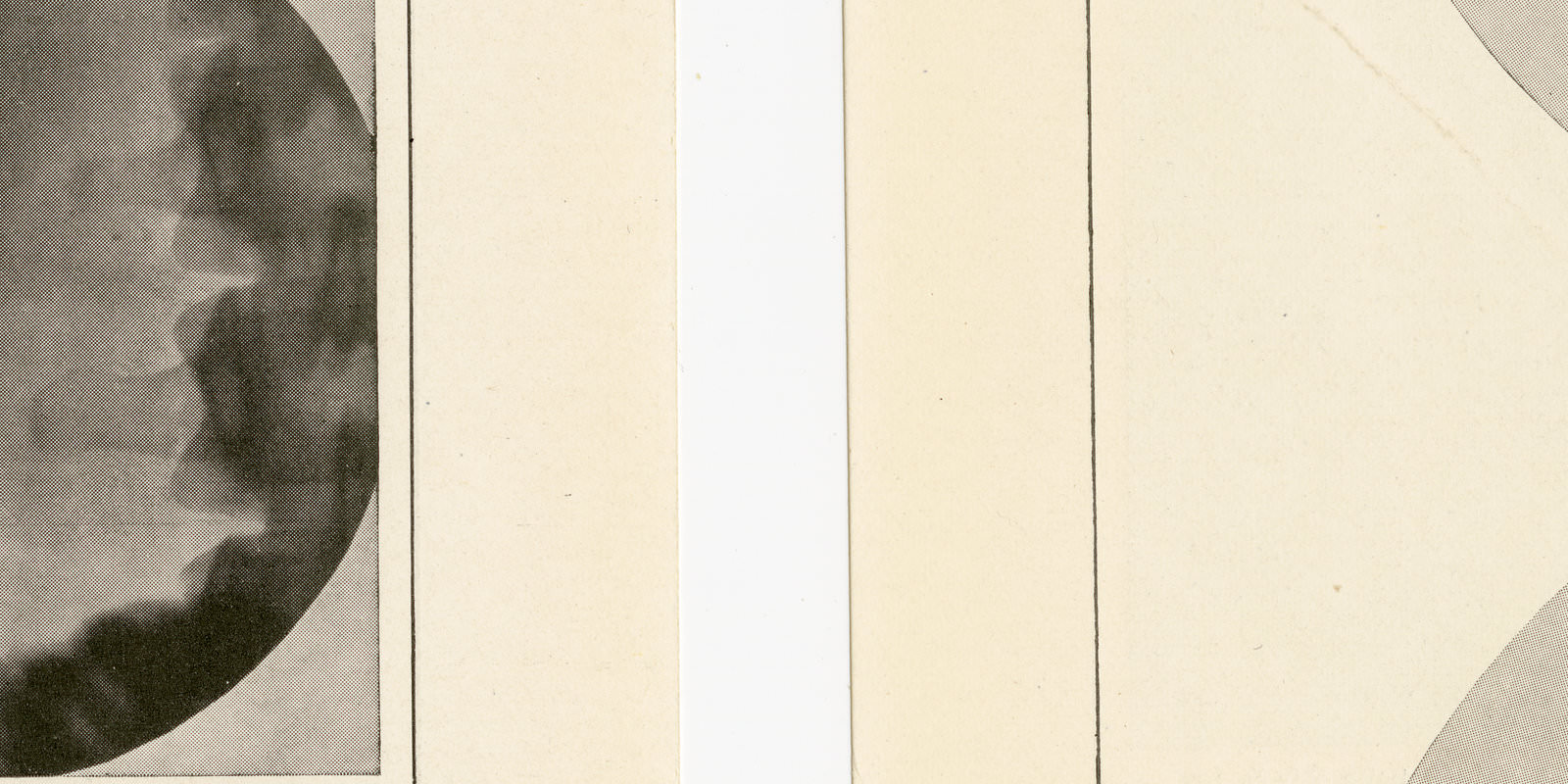 Röntgenbilder I - II ca 1929 historische Bildtafel Autotypie