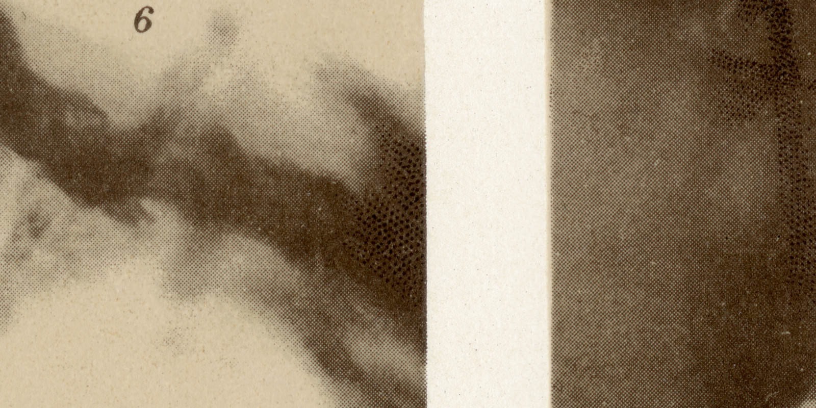 Röntgenstrahlen historische Bildtafel Chromotypie ca 1911