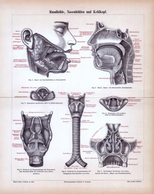 Stich aus 1885 zeigt medizinische Darstelungen von Mundhöhle, kehlkopf udn Nasenhöhlen.