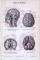 Medizinische Abhandlung aus 1893 zeigt das Gehirn des Menschen in verschiedenen Parspektiven.