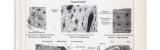 Stich aus 1893 zeigt Schnitte von menschlichem Gewebe.