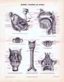 Stich aus 1893 zeigt medizinische Darstelungen von Mundhöhle, kehlkopf udn Nasenhöhlen.
