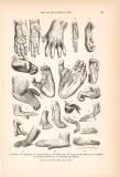Stich aus dem Jahr 1890 zeigt Hände und Füße...