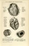 Das Herz des Menschen historische Bildtafel Holzstich ca. 1892