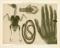 Röntgenstrahlen Chromolithographie 1891 Original der Zeit