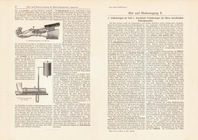 Blut und Blutbewegung II. - III. historischer Druck Holzstich ca. 1903