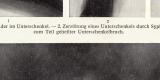 Röntgenbilder I. - II. historischer Druck Autotypie ca. 1907