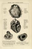 Das Herz des Menschen historische Bildtafel Holzstich ca. 1898